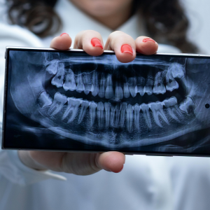 Panoramic X-rays