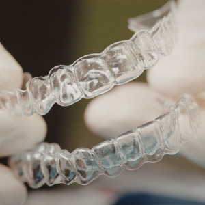 aligner