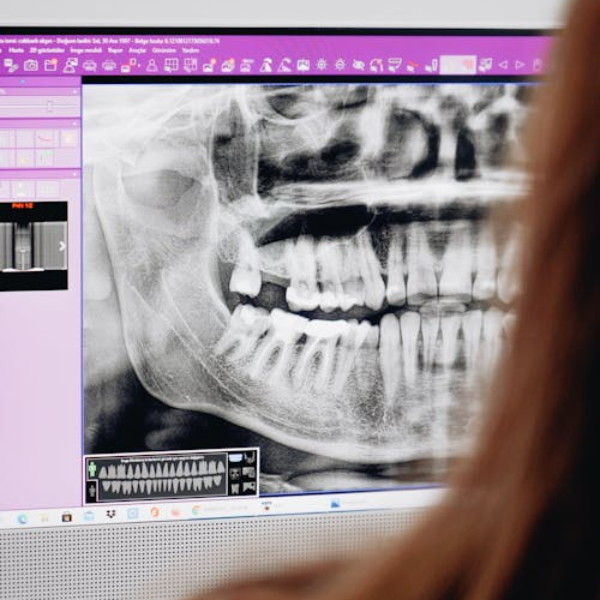 ct scan 3