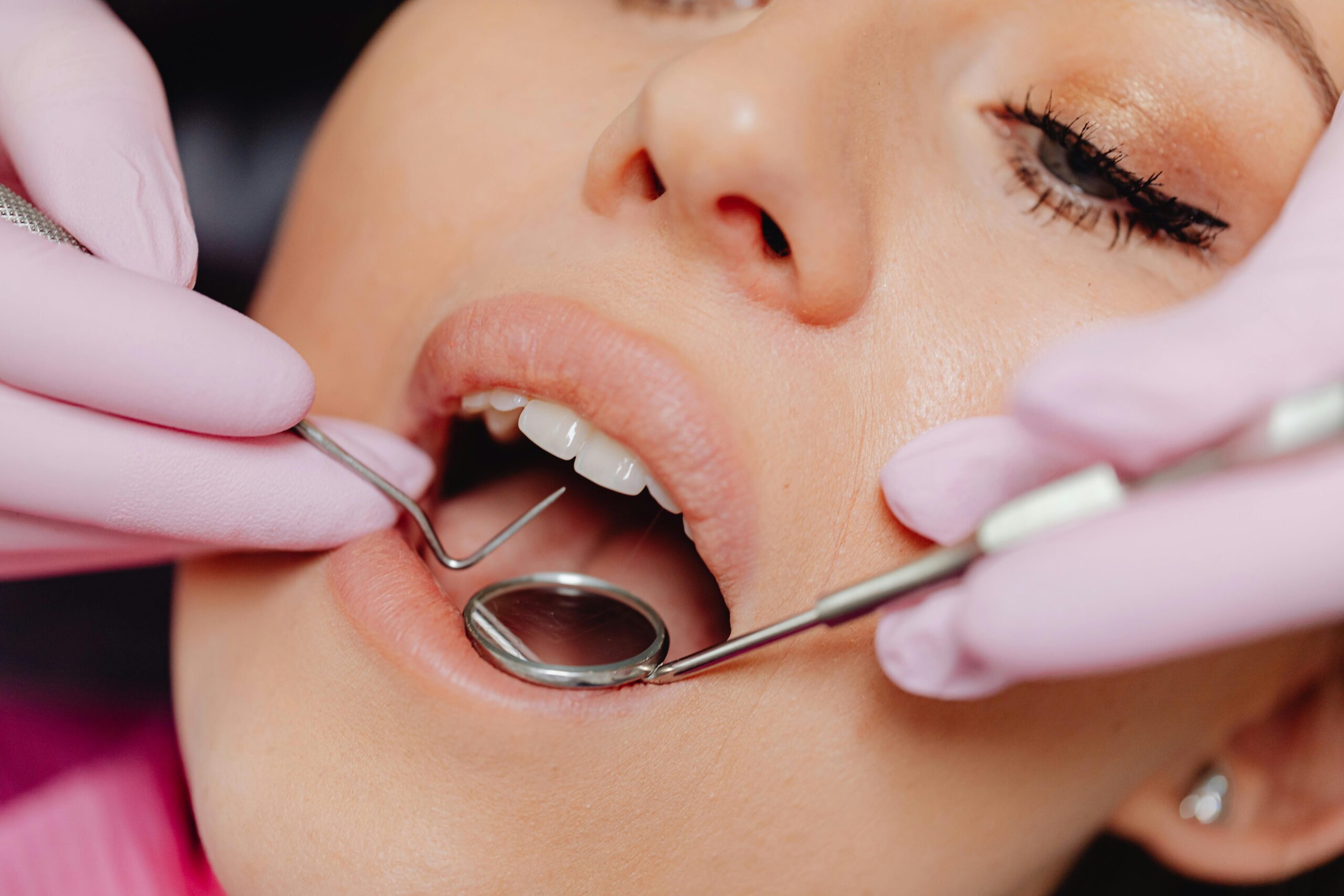 Why Are My Teeth Sensitive to Hot?