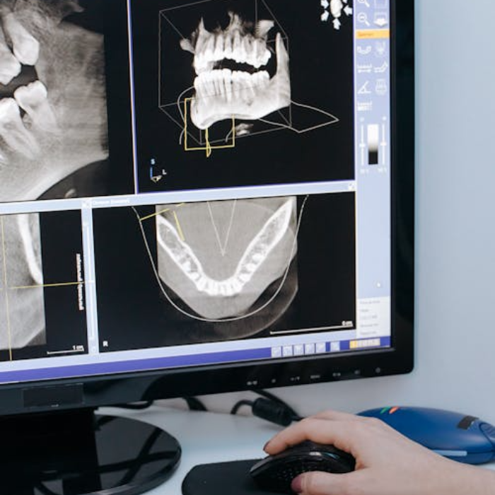 x-ray
